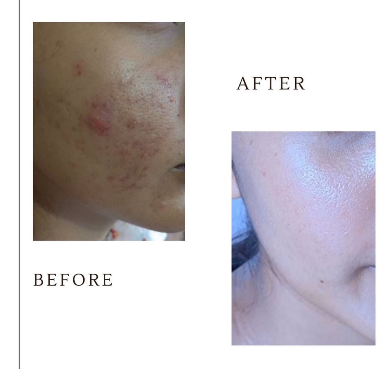 Patient Result 01