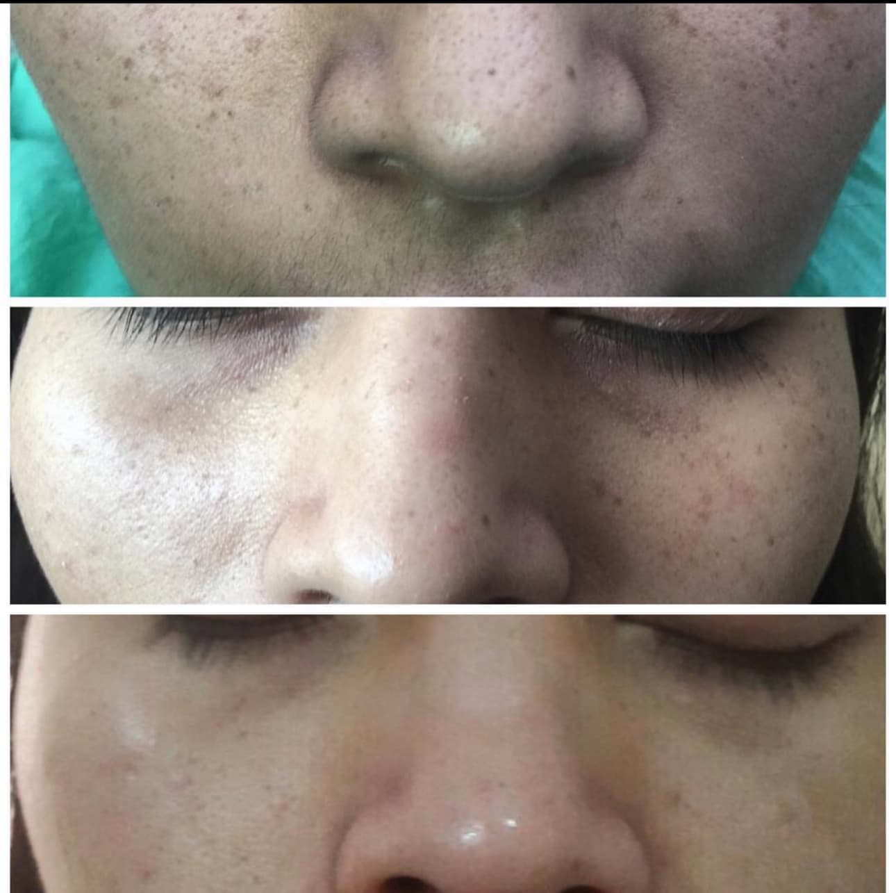Patient Result 02