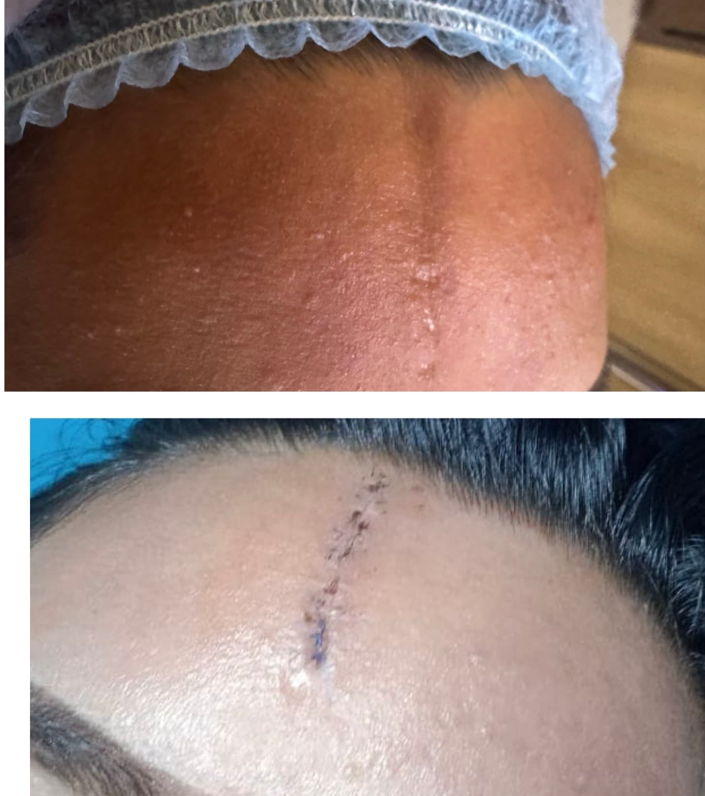 Patient Result 03