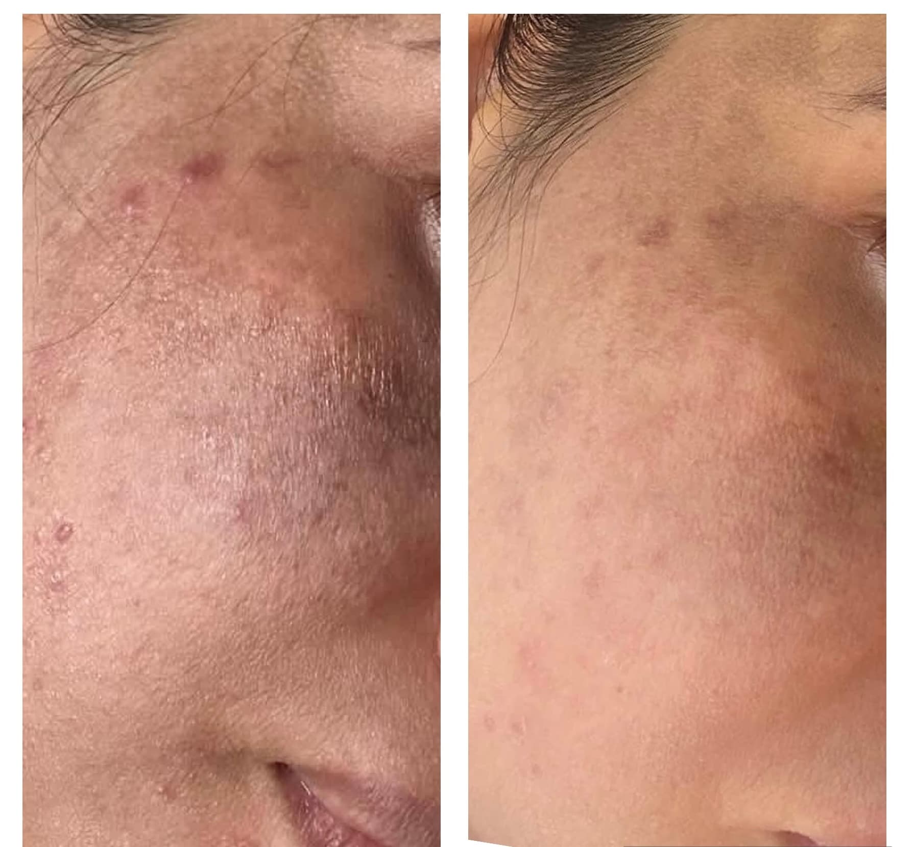 Patient Result 05