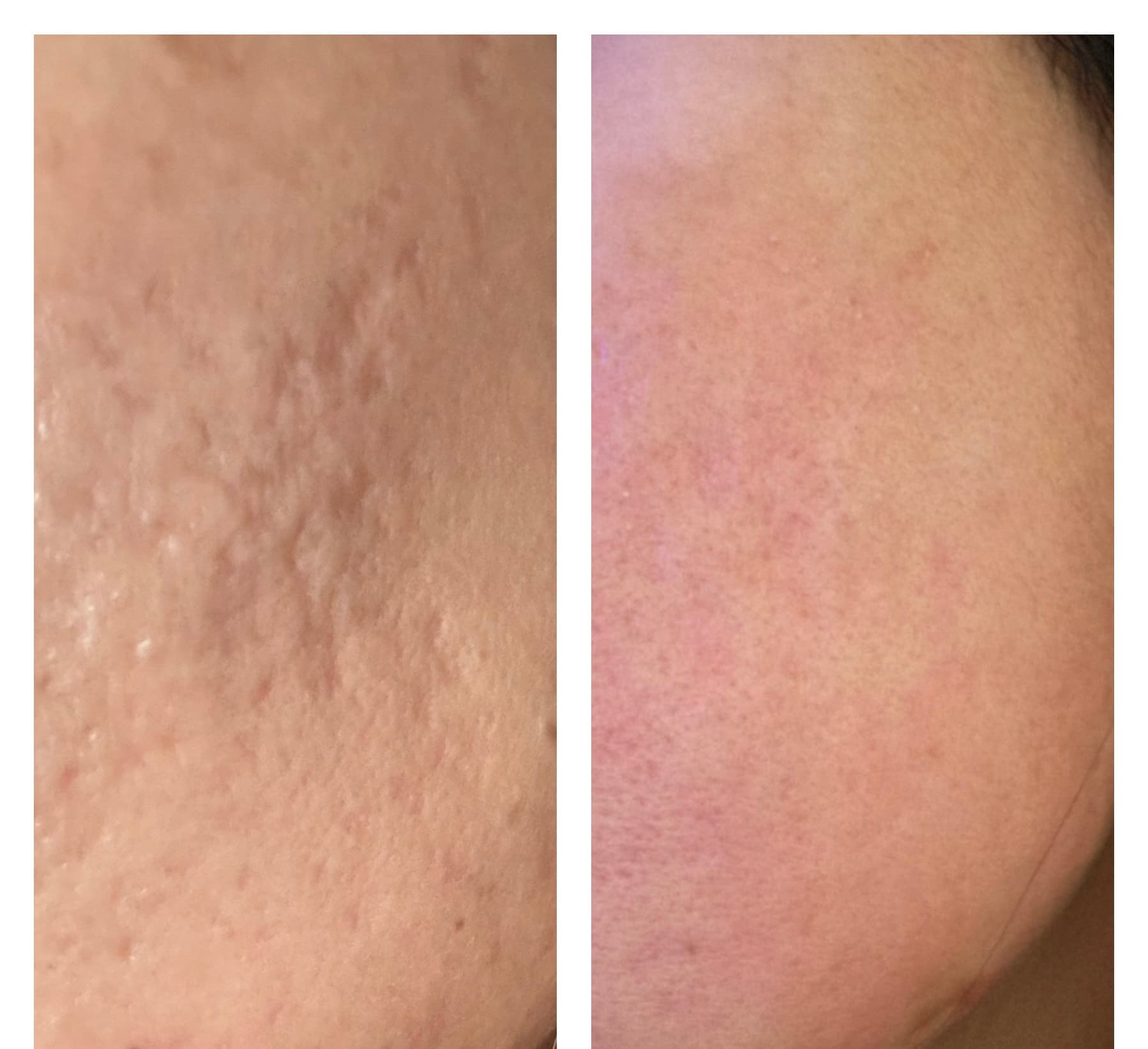 Patient Result 06