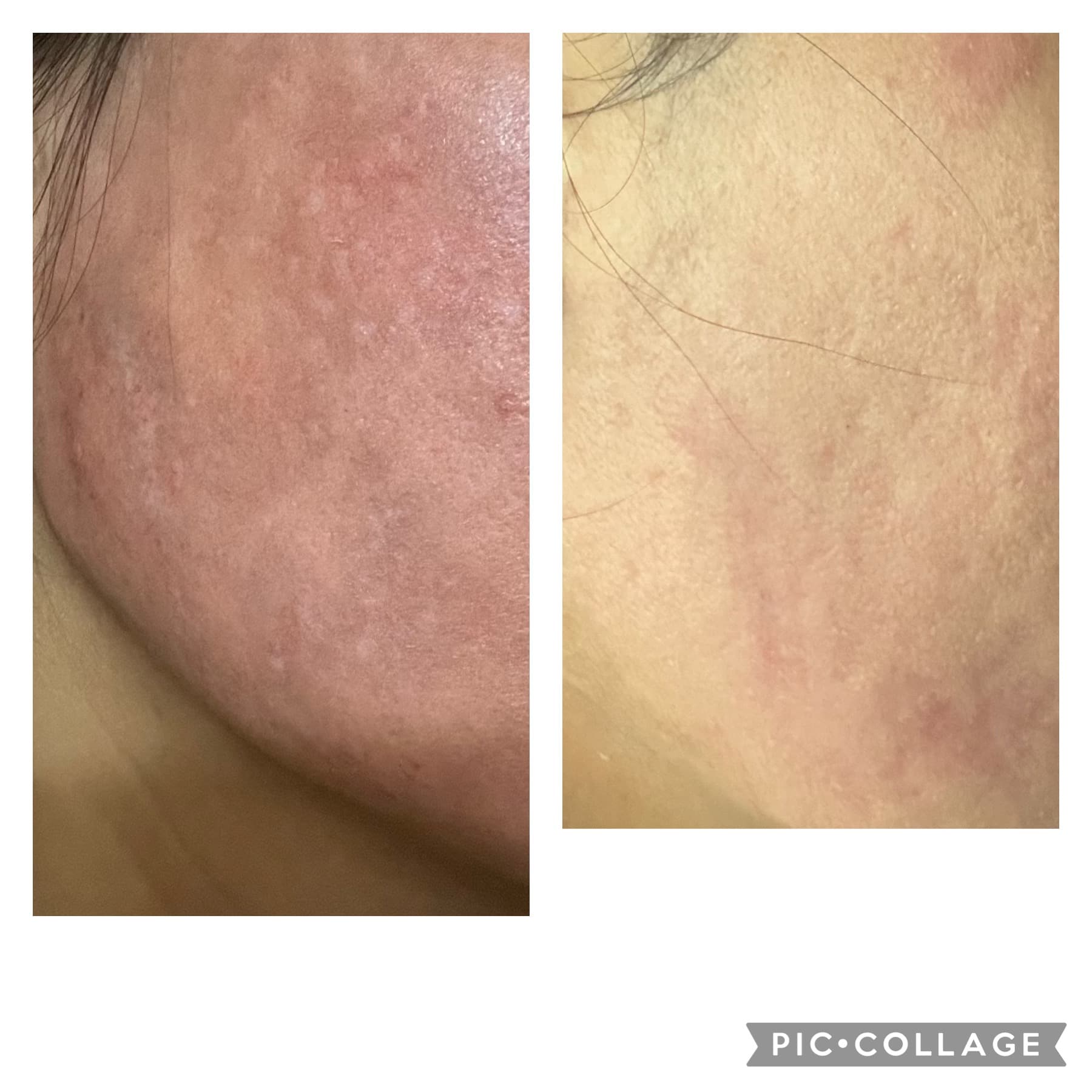 Patient Result 08