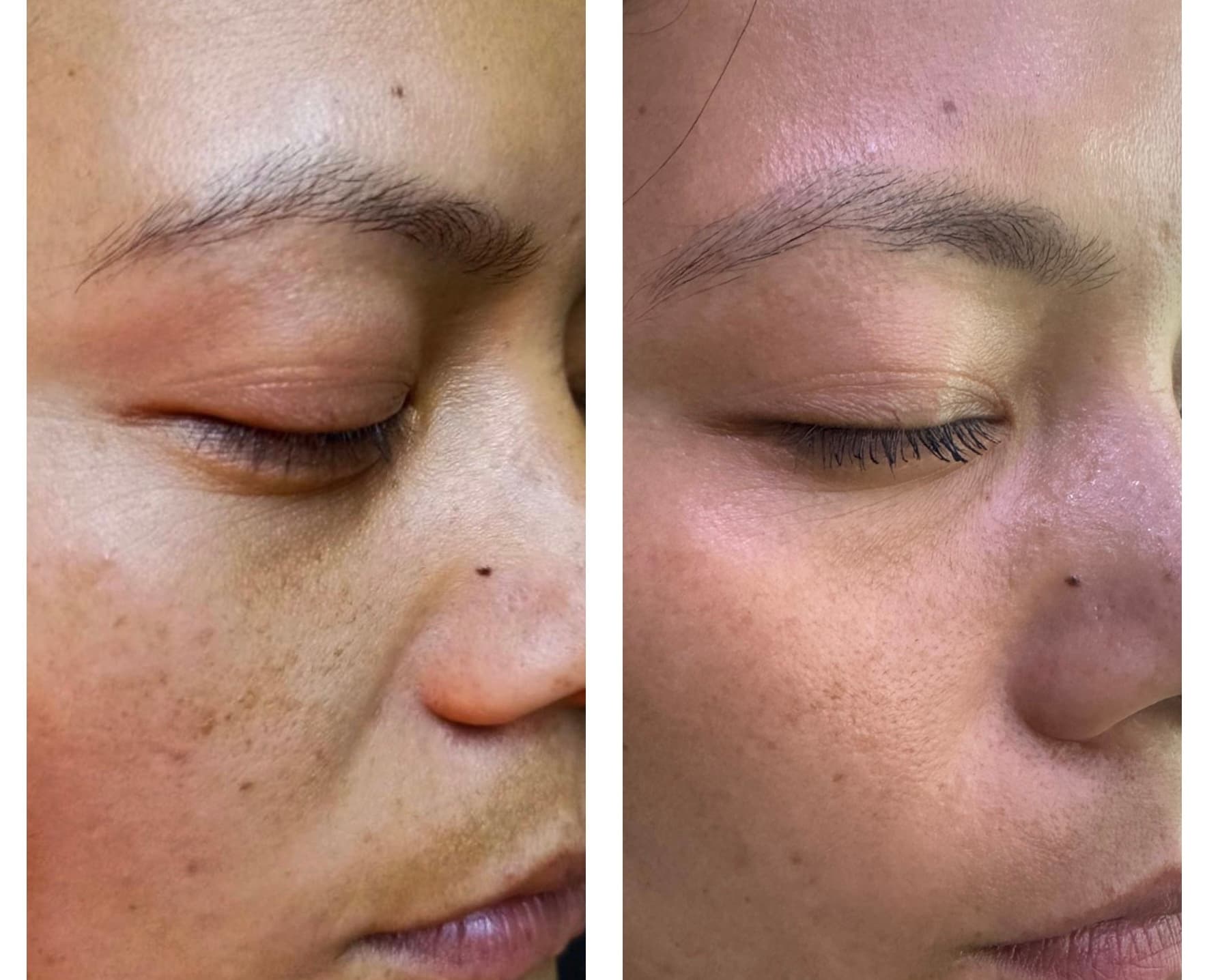 Patient Result 09