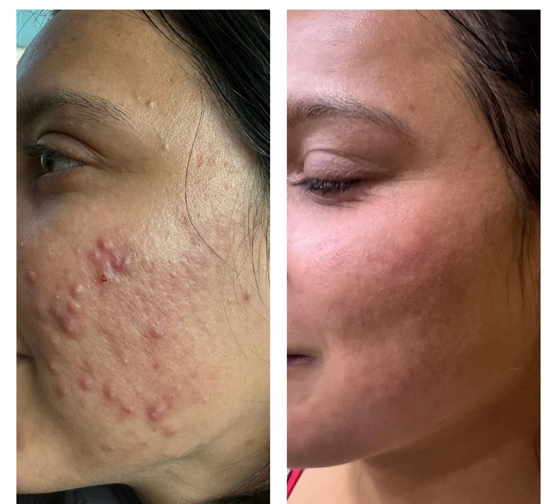 Patient Result 10