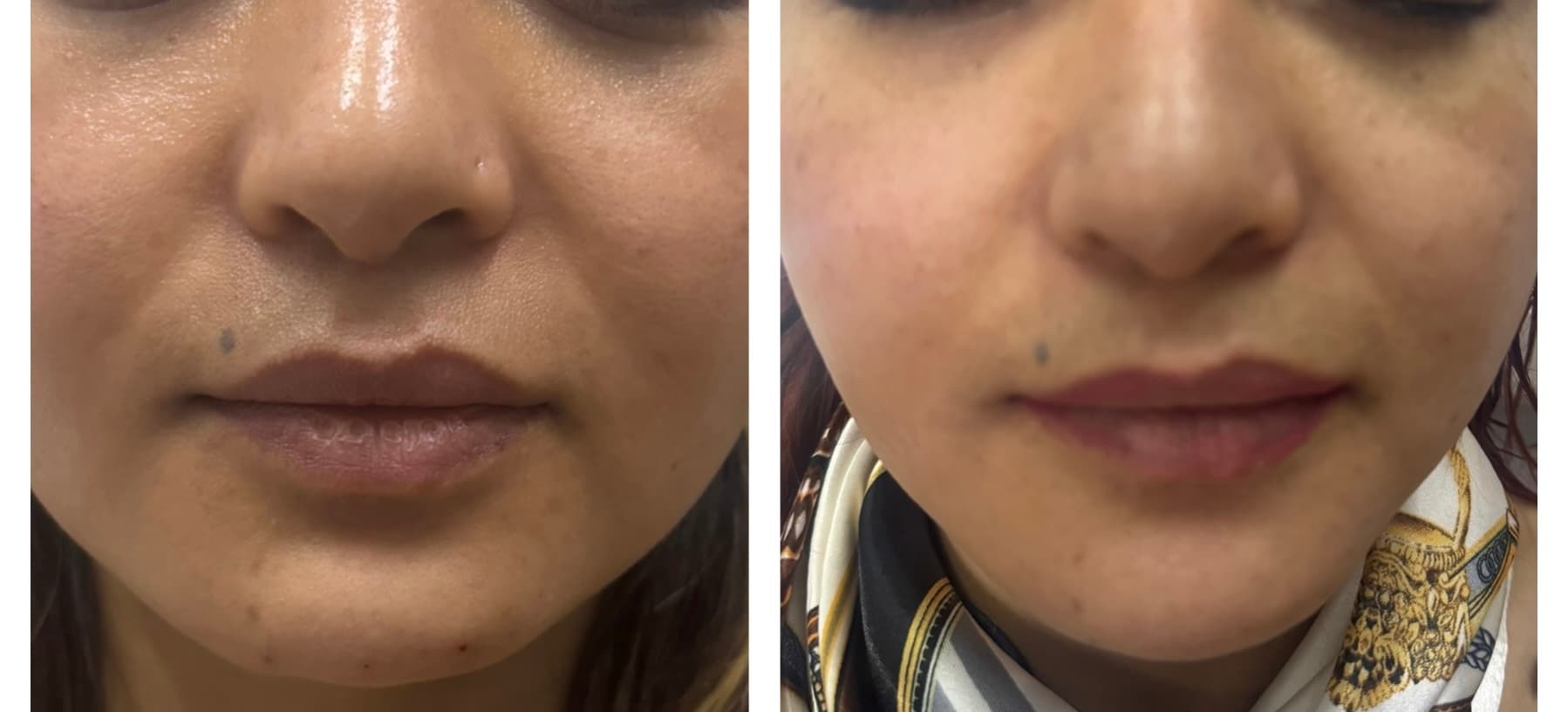 Patient Result 11