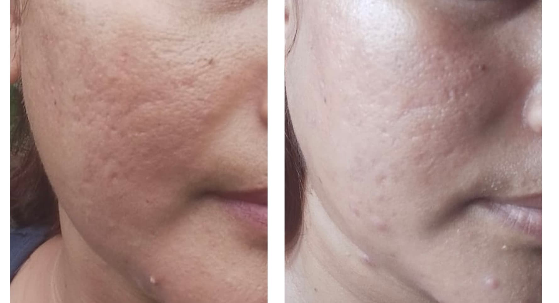 Patient Result 13